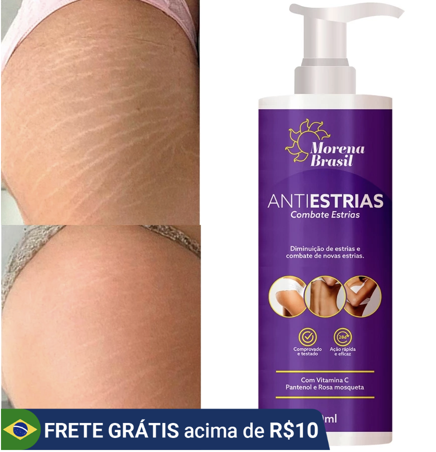 Creme AntiEstrias Removedor Estrias 200g Morena Brasil – Ação Poderosa com Colágeno e Elastina